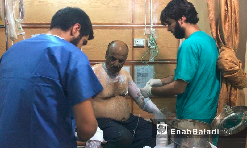 مصاب بحروق يتلقى العلاج داخل مشفى القدس في حلب - الأحد 14 آب (عنب بلدي)