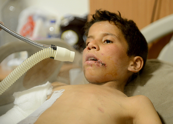 عبد العظيم جاويد- طفل سوري- مشفى كلس- تركيا (الأناضول)