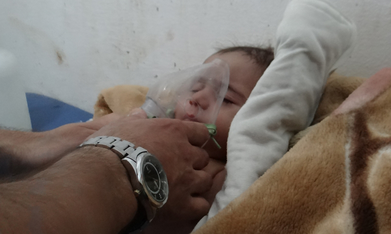 طفل مصاب بغاز الكلور في سراقب بمدينة إدلب- آب 2016( الأناضول)