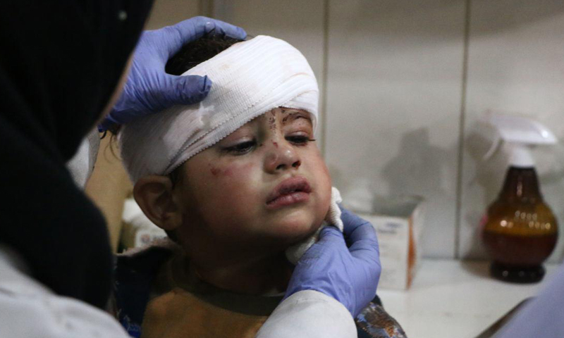 طفل جريح جراء القصف الجوي الذي طال مناطق الغوطة الشرقية- 7 شباط 2018 ( مركز الغوطة الإعلامي)