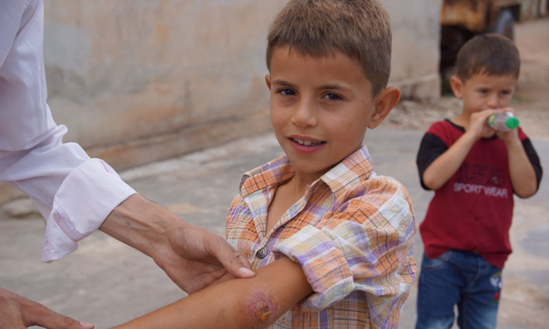 طفل مصاب بمرض الليشمانيا في حماه (عنب بلدي)