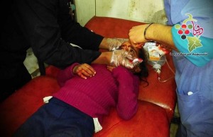 طفلة جريحة في قصف قوات الأسد لدوما فجر اليوم