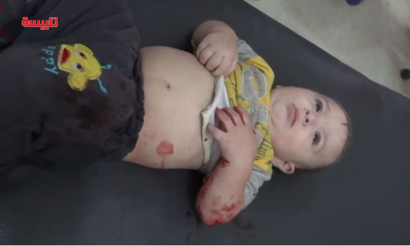 طفلة مصابة جراء الغارات على مدينة تلبيسة- الثلاثاء 20 أيلول (يوتيوب)