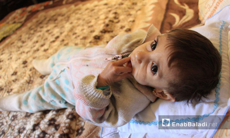 حلا النوفي (عامان) بدون دواء في الغوطة الشرقية - كانون الأول 2017 (عنب بلدي)