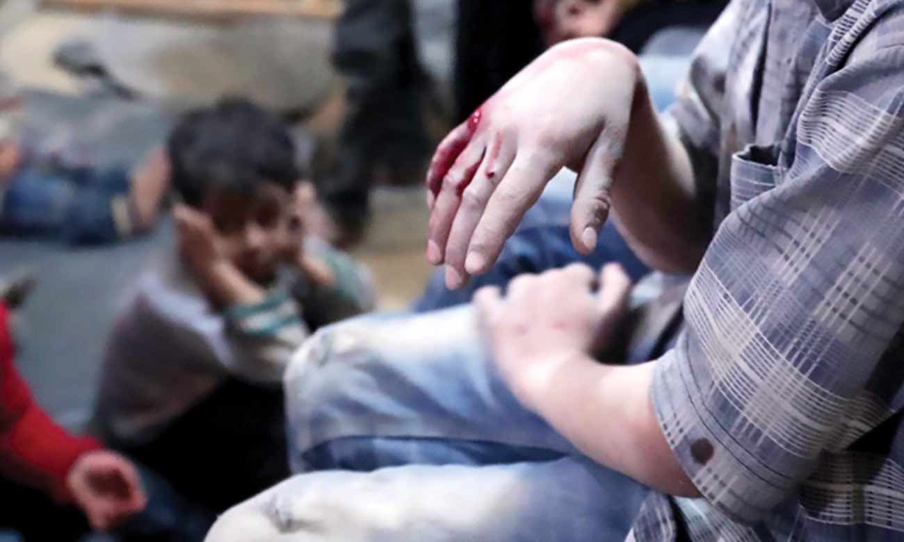 أطفال مصابون إثر القصف في سوريا - 2017 (AFP)