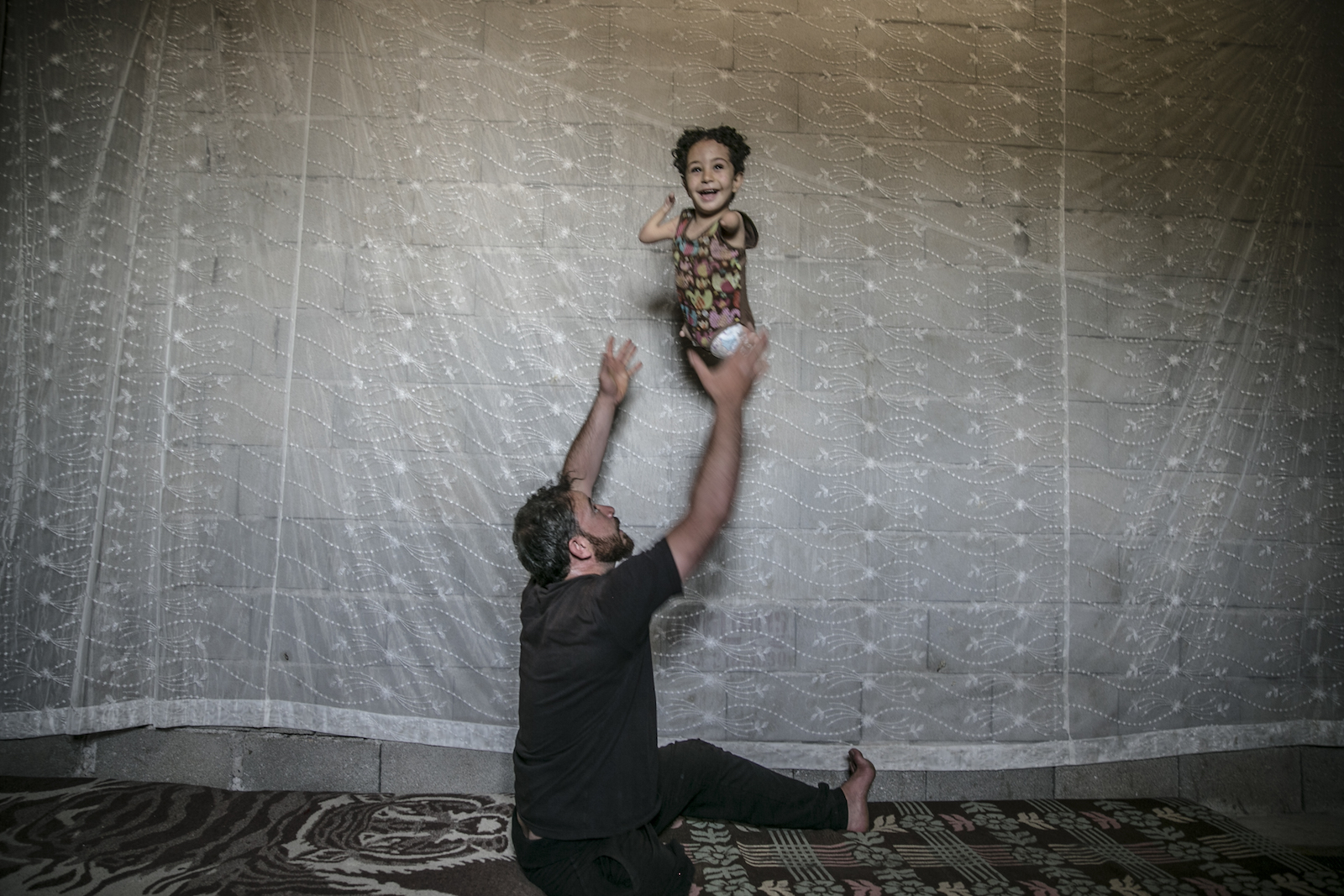 أب سوري فقد ساقه اليمنى في الحرب في سوريا واضطر إلى مواصلة حياته بالرصاصة التي أصابت ظهره وهو يداعب ابنته التي ولدت بتشوه خلقي (الأناضول)