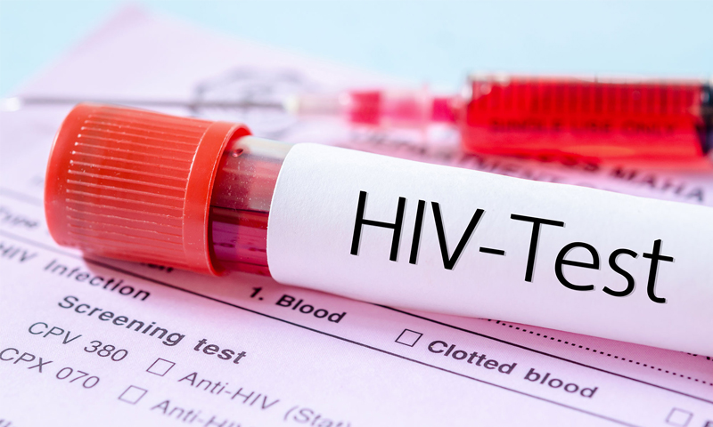 صورة تعبيرية لفحص فيروس "الإيدز" - (fotolia.com)