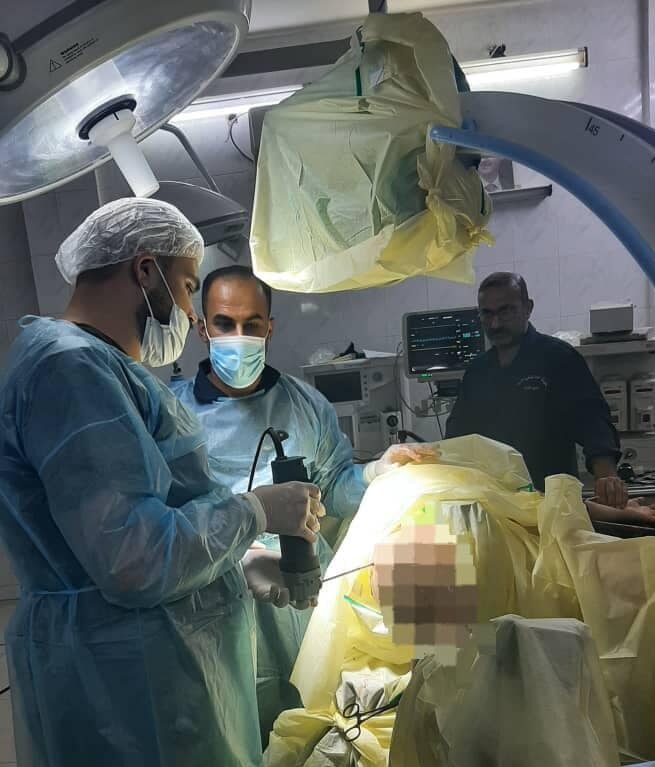 تثبيت لمشاش رأس الفخذ في مستشفى "الأسد" بدير الزور - 30 من أيار 2023 (المكتب الإعلامي لمشفى الأسد بدير الزر/ فيس بوك)