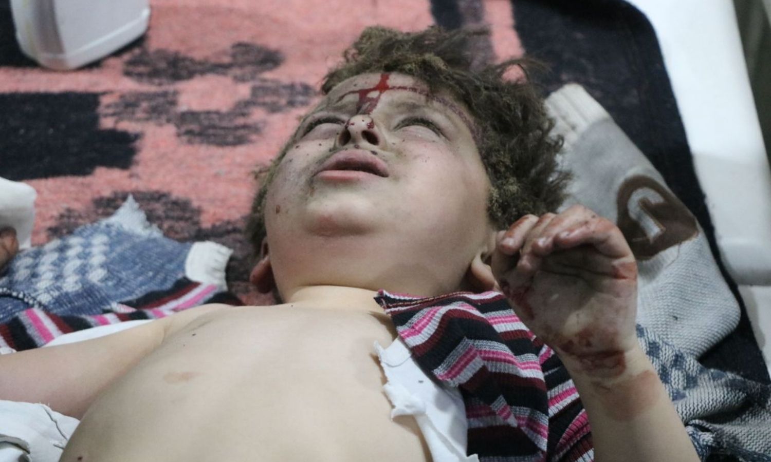 طفل مصاب جراء القصف الذي استهدف مدينة دارة عزة - 10 من آذار 2024 (الدفاع المدني السوري)