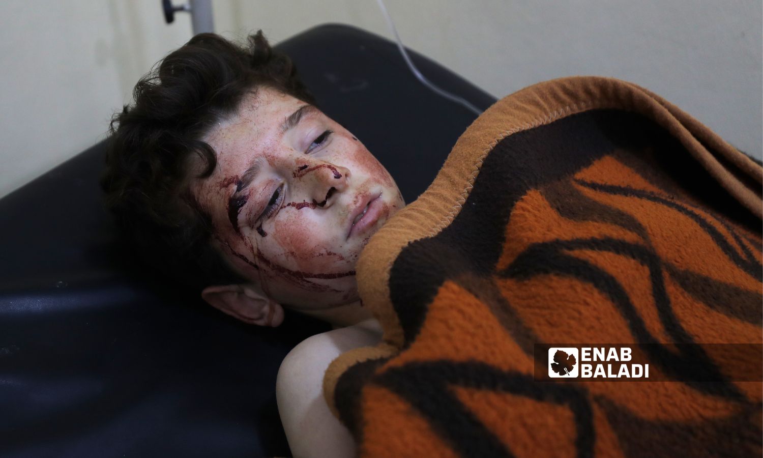 ضحايا إثر قصف من قبل قوات النظام السوري استهدف الأحياء السكنية في مدينة سرمين بريف إدلب الشرقي - 1 من نيسان 2024(عنب بلدي\ أنس الخولي)