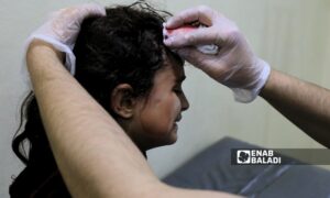 طفلة مصابة في قصف قوات النظام السوري للأحياء السكنية بمدينة سرمين في ريف إدلب الشرقي - 1 من نيسان 2024 (عنب بلدي/أنس الخولي)