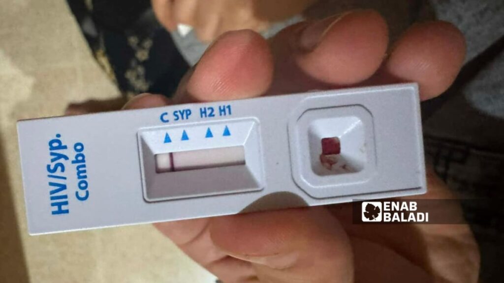 اختبار سريع للكشف عن فيروس نقص المناعة البشرية (HIV) الذي تتيح وزارة الصحة إجراءه ضمن مراكز المشورة والفحص الطوعي - 30 تموز 2026 (عنب بلدي)