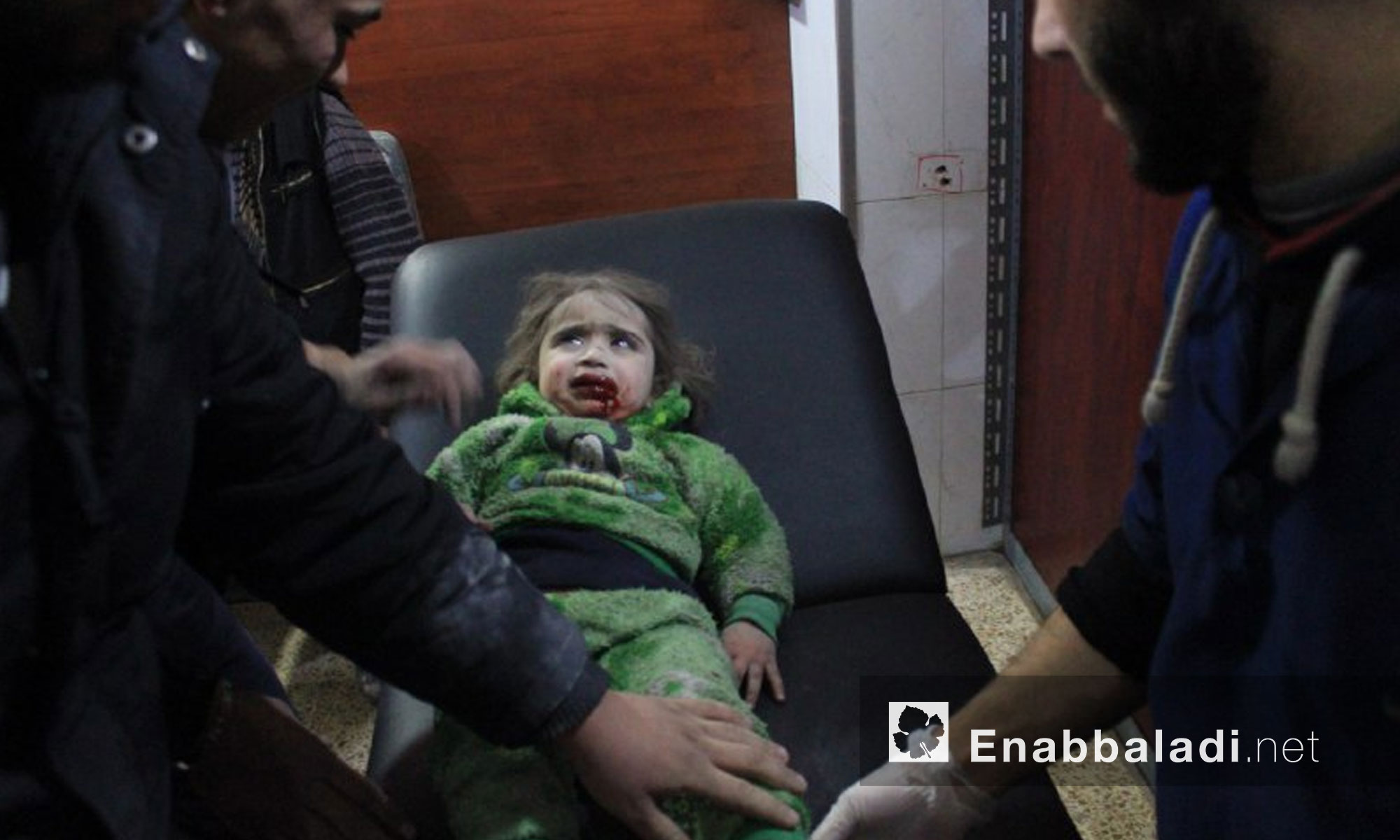 Injured children due to the attack on Hamouriyah in Eastern Ghouta – 9 January 2018 (Enab Baladi)