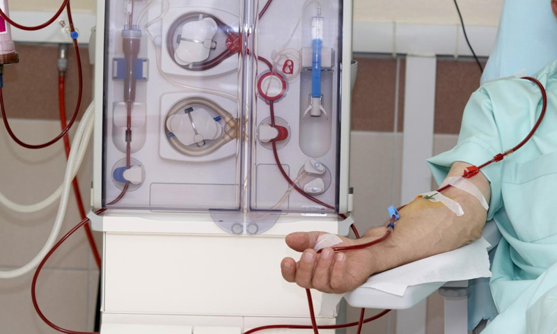 A patient undergoing a kidney dialysis session (Medical News Today website)
