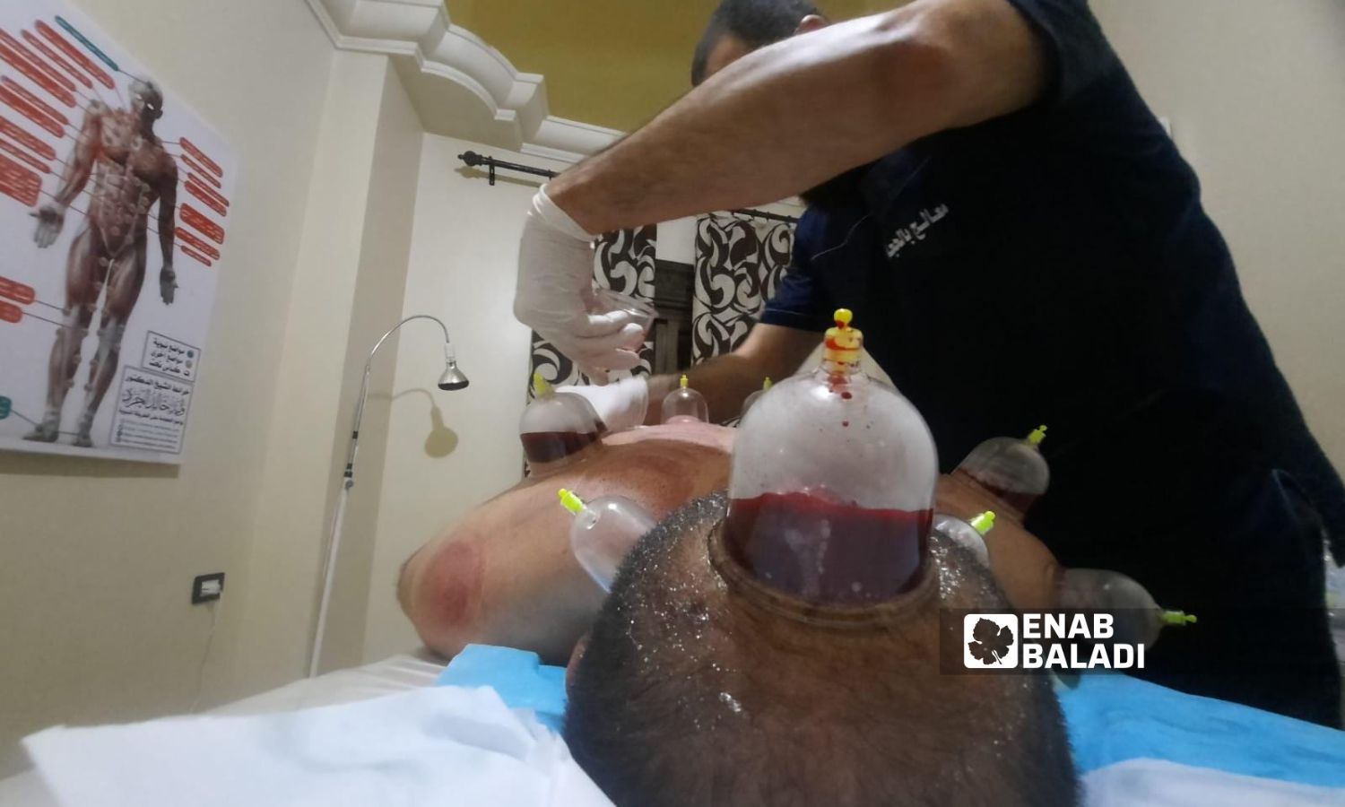 A cupping therapy center in the northwestern city of Idlib, northern Syria - June 5, 2023 (Enab Baladi/Shams al-Din Matoun)